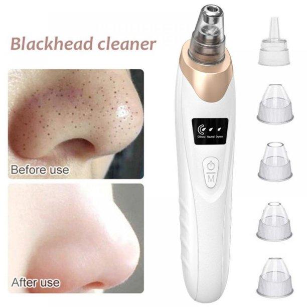 Electric Vacuum Blackhead Remover Acne Black Spot Extractor Pore Cleaner